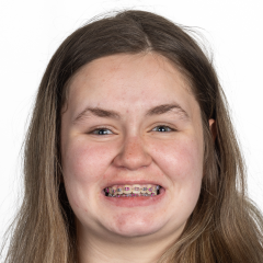 A.Jones_Alpine Skiing.png